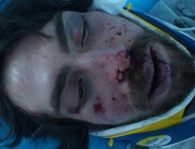 Συνελήφθη δράστης του άγριου ξυλοδαρμού του 24χρονου φοιτητή